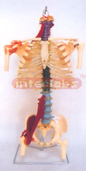 HUMAN DISEASE SKELETAL TORSO MODEL